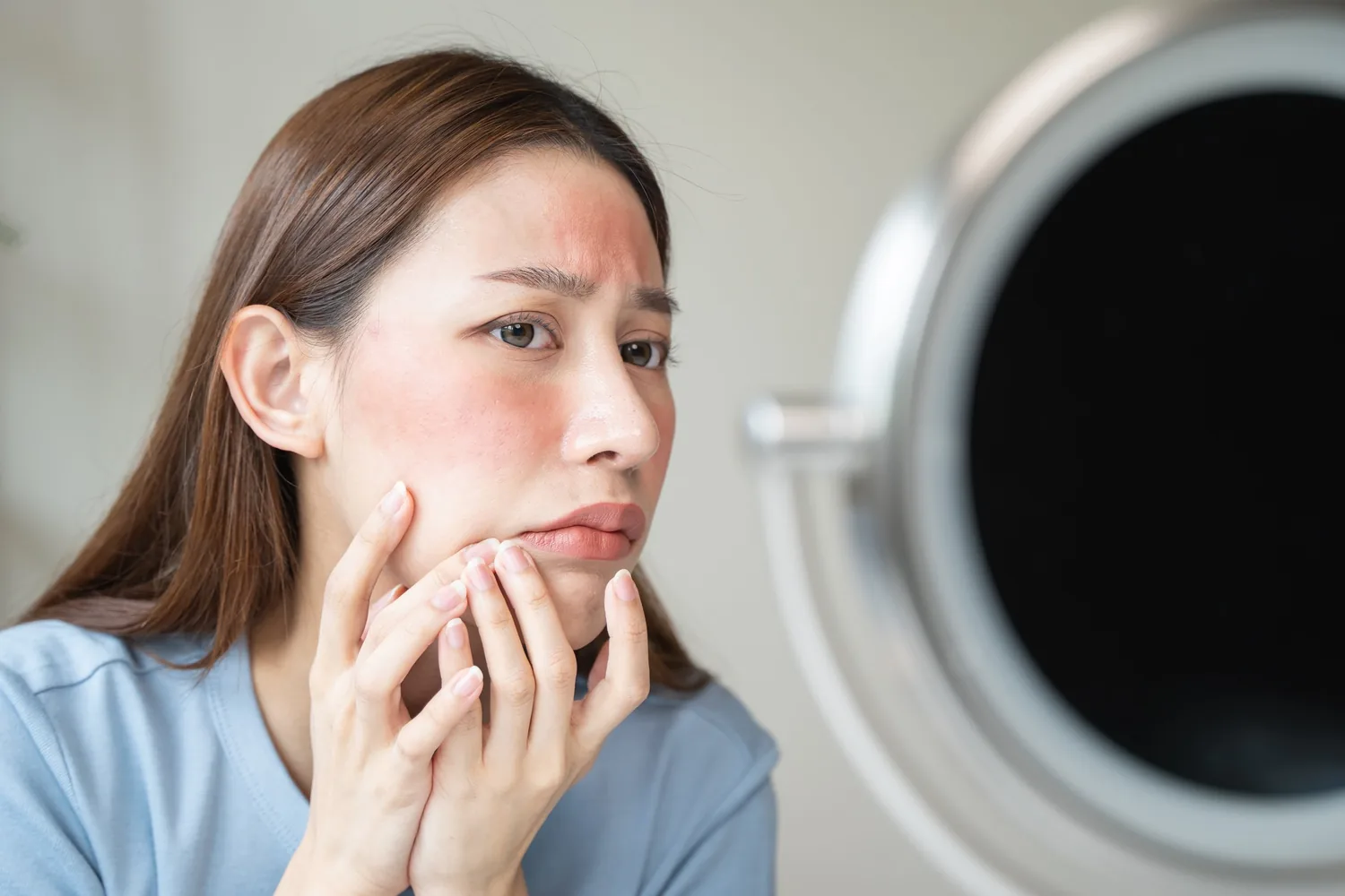 medical dermatology woman woman-looking-her-rosacea-mirror